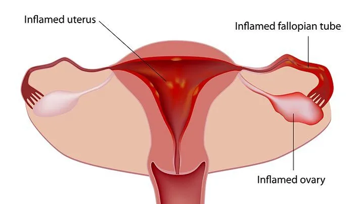 10 Surprising Ways Sex Can Relieve Abdominal Pain (Backed by Science)